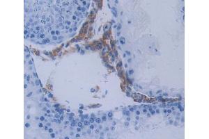 IHC-P analysis of Kidney tissue, with DAB staining. (METTL21C anticorps  (AA 1-248))
