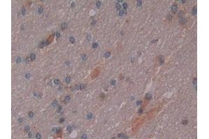 Detection of OPN in Human Cerebrum Tissue using Polyclonal Antibody to Osteopontin (OPN)