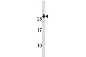 GSTT2 antibody western blot analysis in A549 lysate. (GSTT2 anticorps  (AA 113-141))