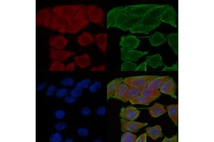 ABIN6258774 and ABIN6274538 staining Hela cells(30 min of UV treatment) by IF/ICC. (EPH Receptor A6 anticorps  (C-Term))