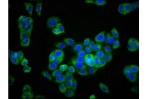 Immunofluorescence staining of PC-3 cells with ABIN7163936 at 1:166, counter-stained with DAPI. (KCNK9 anticorps  (AA 250-362))