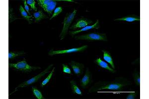 Immunofluorescence of purified MaxPab antibody to MMAB on HeLa cell. (MMAB anticorps  (AA 1-250))