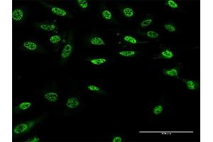 Immunofluorescence of monoclonal antibody to PAX9 on HeLa cell.