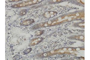Immunoperoxidase of monoclonal antibody to MAP3K4 on formalin-fixed paraffin-embedded human small Intestine. (MAP3K4 anticorps  (AA 1201-1300))