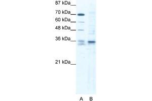 WB Suggested Anti-SOX12 Antibody Titration: 1.