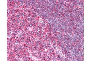 HSPA8 antibody was used for immunohistochemistry at a concentration of 4-8 ug/ml. (Hsc70 anticorps  (N-Term))