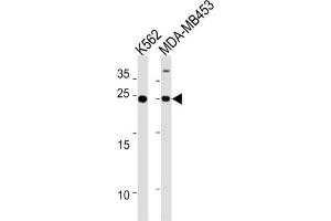 Western Blotting (WB) image for anti-Sarcospan (Kras Oncogene-Associated Gene) (SSPN) antibody (ABIN3004662) (SSPN anticorps)