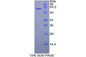 SDS-PAGE (SDS) image for CD34 (CD34) (AA 36-287) protein (His tag,GST tag) (ABIN1879523) (CD34 Protein (CD34) (AA 36-287) (His tag,GST tag))