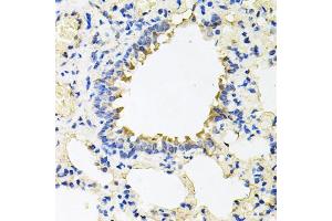 Immunohistochemistry of paraffin-embedded rat lung using CALU antibody (ABIN5973922) at dilution of 1/100 (40x lens). (CALU anticorps)