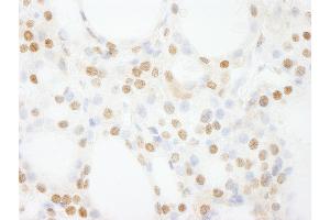 Immunohistochemistry (IHC) image for anti-General Transcription Factor IIIC, Polypeptide 4 (GTF3C4) (AA 1-50) antibody (ABIN7453712)