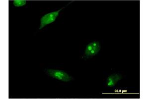 Immunofluorescence of monoclonal antibody to RPL10L on HeLa cell. (RPL10L anticorps  (AA 115-214))
