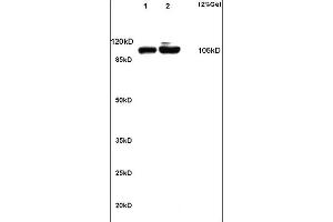 Lane 1: rat kidney lysates Lane 2: rat brain lysates probed with Anti alpha Actinin 4 Polyclonal Antibody, Unconjugated (ABIN733778) at 1:200 in 4 °C. (alpha Actinin 4 anticorps)