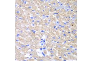 Immunohistochemistry of paraffin-embedded mouse heart using GPAM antibody (ABIN5973973) at dilution of 1/100 (40x lens). (GPAM anticorps)