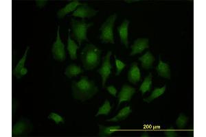 Immunofluorescence of monoclonal antibody to TBX3 on HeLa cell.
