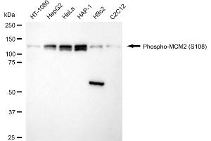 Western blotting analysis using phospho-MCM2 (S108) antibody (ABIN7799416).