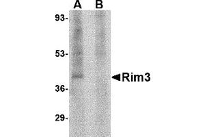 Western Blotting (WB) image for anti-Regulating Synaptic Membrane Exocytosis 3 (RIMS3) (N-Term) antibody (ABIN1031542) (RIMS3 anticorps  (N-Term))