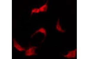 ABIN6275250 staining LOVO by IF/ICC. (SLC16A3 anticorps  (Internal Region))