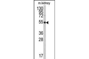 Western blot analysis of anti-ALDH9A1 Antibody (N-term) (ABIN6242161 and ABIN6579017) in mouse kidney tissue lysates (35 μg/lane).