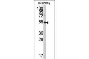 Western blot analysis of anti-ALDH9A1 Antibody (N-term) (ABIN6242161 and ABIN6579017) in mouse kidney tissue lysates (35 μg/lane). (ALDH9A1 anticorps  (N-Term))