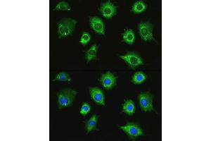 Immunofluorescence analysis of L929 cells using ZAK Rabbit pAb (ABIN7268664) at dilution of 1:100. (ZAK anticorps  (AA 100-312))