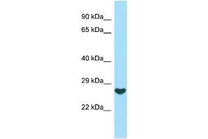 WB Suggested Anti-FGF16 Antibody Titration: 1. (FGF16 anticorps  (C-Term))