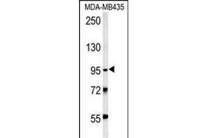TRHDE Antibody (C-term) (ABIN651822 and ABIN2840414) western blot analysis in MDA-M cell line lysates (15 μg/lane). (TRHDE anticorps  (C-Term))