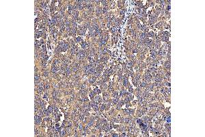 IHC analysis of SH2D4A using anti-SH2D4A antibody (ABIN7601695). (SH2D4A anticorps  (AA 42-454))