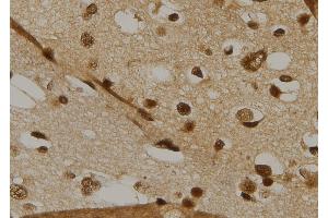 ABIN6269215 at 1/100 staining Human brain tissue by IHC-P.