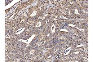 IHC analysis of ACADM/MCAD using anti-ACADM/MCAD antibody (ABIN7601543). (Medium-Chain Specific Acyl-CoA Dehydrogenase, Mitochondrial (MCAD) (AA 38-401) anticorps)