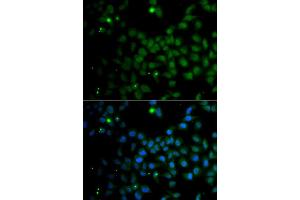 Immunofluorescence analysis of A549 cells using SMAD9 antibody (ABIN5975592). (SMAD9 anticorps)
