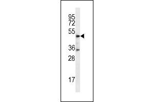 DSN1 Antibody (C-term) (ABIN656747 and ABIN2845971) western blot analysis in MDA-M cell line lysates (35 μg/lane). (DSN1 anticorps  (C-Term))