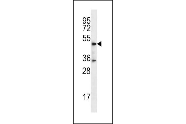 DSN1 anticorps  (C-Term)