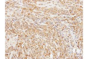 IHC-P Image Immunohistochemical analysis of paraffin-embedded SAS xenograft, using BCHE, antibody at 1:100 dilution.