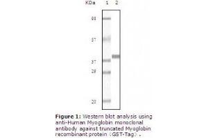 Image no. 2 for anti-Myoglobin (MB) antibody (ABIN207623) (Myoglobin anticorps)