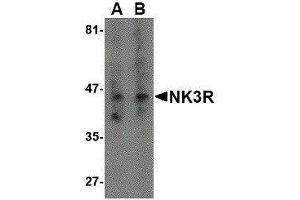 Western Blotting (WB) image for anti-Tachykinin Receptor 3 (TACR3) antibody (ABIN2476672)