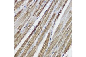 Immunohistochemistry of paraffin-embedded rat kidney using GLB1 Rabbit pAb (ABIN3015642, ABIN3015643, ABIN3015644 and ABIN6218995) at dilution of 1:100 (40x lens). (GLB1 anticorps  (AA 1-270))