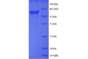 Casein Kinase 1, epsilon (CSNK1E) (AA 17-231) protein (GST tag) (CK1 epsilon Protein (AA 17-231) (GST tag))