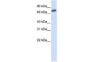 TRIM45 antibody used at 1 ug/ml to detect target protein. (TRIM45 anticorps  (N-Term))