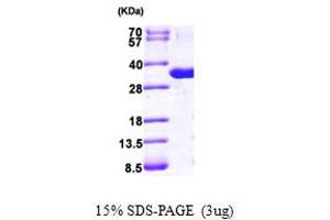 SDS-PAGE (SDS) image for Nucleoside Phosphorylase (NP) (AA 1-289) protein (His tag) (ABIN667267)