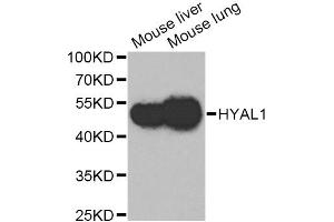 Western blot analysis of extracts of various cell lines, using HYAL1 Antibody. (HYAL1 anticorps)