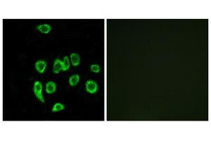 Immunofluorescence analysis of A549 cells, using MRPL32 antibody. (MRPL32 anticorps  (Internal Region))
