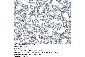 Human Lung (AKAP8L anticorps  (C-Term))