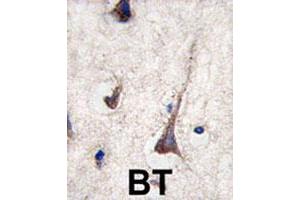 Formalin-fixed and paraffin-embedded human brain tissue reacted with CD3G polyclonal antibody  , which was peroxidase-conjugated to the secondary antibody, followed by DAB staining. (CD3G anticorps  (N-Term))