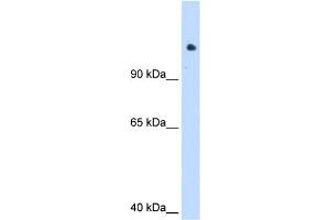 WB Suggested Anti-SMARCAL1 Antibody Titration:  1. (SMARCAL1 anticorps  (C-Term))