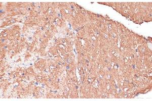 Immunohistochemistry of paraffin-embedded Mouse heart using FRMD6 Polyclonal Antibody at dilution of 1:100 (40x lens). (FRMD6 anticorps)