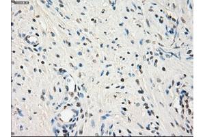 Immunohistochemical staining of paraffin-embedded endometrium tissue using anti-LTA4Hmouse monoclonal antibody. (LTA4H anticorps)