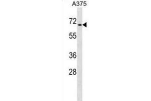 Western Blotting (WB) image for anti-Chromodomain Protein, Y-Like (CDYL) antibody (ABIN2998873) (CDYL anticorps)