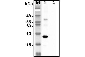 Western blot analysis of recombinant human CTRPs using anti-CTRP1 (human), pAb  at 1:4,000 dilution. (C1QTNF1 anticorps)
