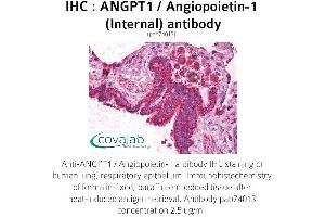 Image no. 1 for anti-Angiopoietin 1 (ANGPT1) (Internal Region) antibody (ABIN1731781) (Angiopoietin 1 anticorps  (Internal Region))