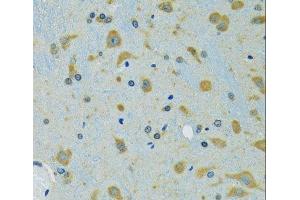 Immunohistochemistry of paraffin-embedded Mouse brain using RPS7 Polyclonal Antibody at dilution of 1:100 (40x lens).